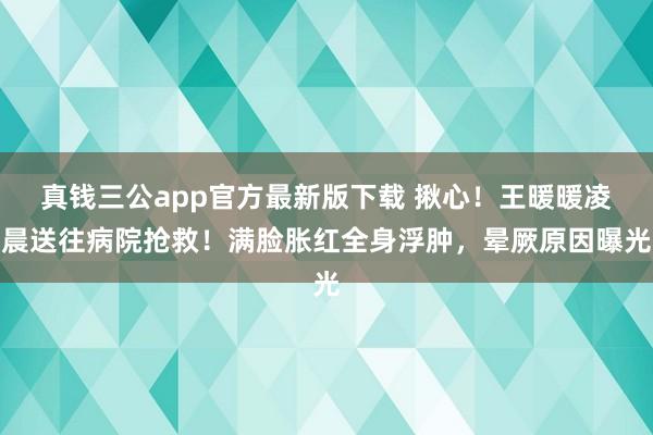 真钱三公app官方最新版下载 揪心！王暖暖凌晨送往病院抢救！满脸胀红全身浮肿，晕厥原因曝光